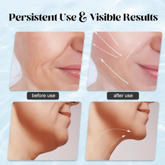 EMS Face & Neck Massager – Red Light Therapy & Anti-Wrinkle Care